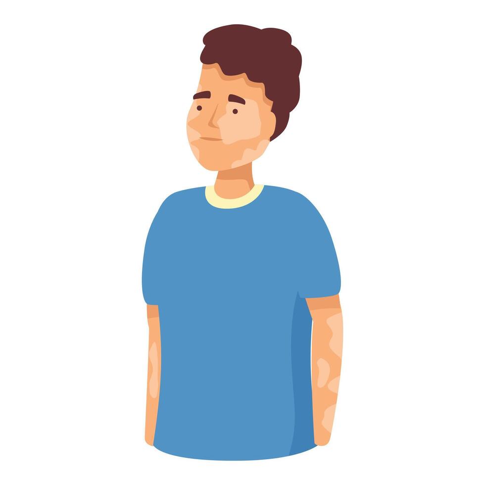 Young man suffering from vitiligo is standing calmly showing his skin pigmentation disease vector