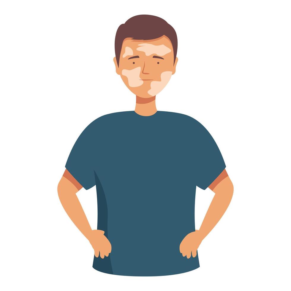 Young confident man with vitiligo skin condition posing with hands on hips vector