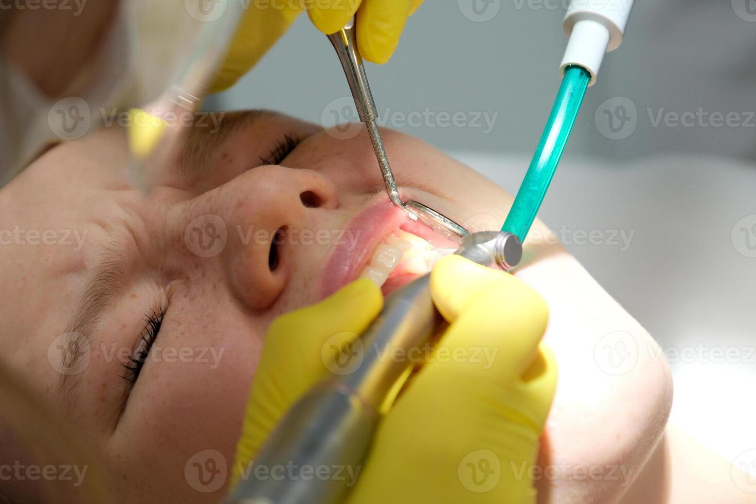 Dentist's hands giving anesthetic injection to female patient during dental procedure in clinic. Doctor making anesthetic injection to woman in dentistry office. Dental treatment concept. Close-up. photo