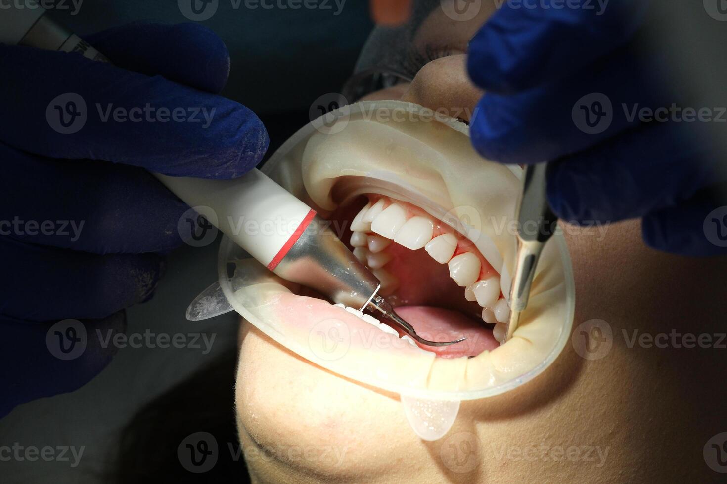 Dentist's hands giving anesthetic injection to female patient during dental procedure in clinic. Doctor making anesthetic injection to woman in dentistry office. Dental treatment concept. Close-up. photo