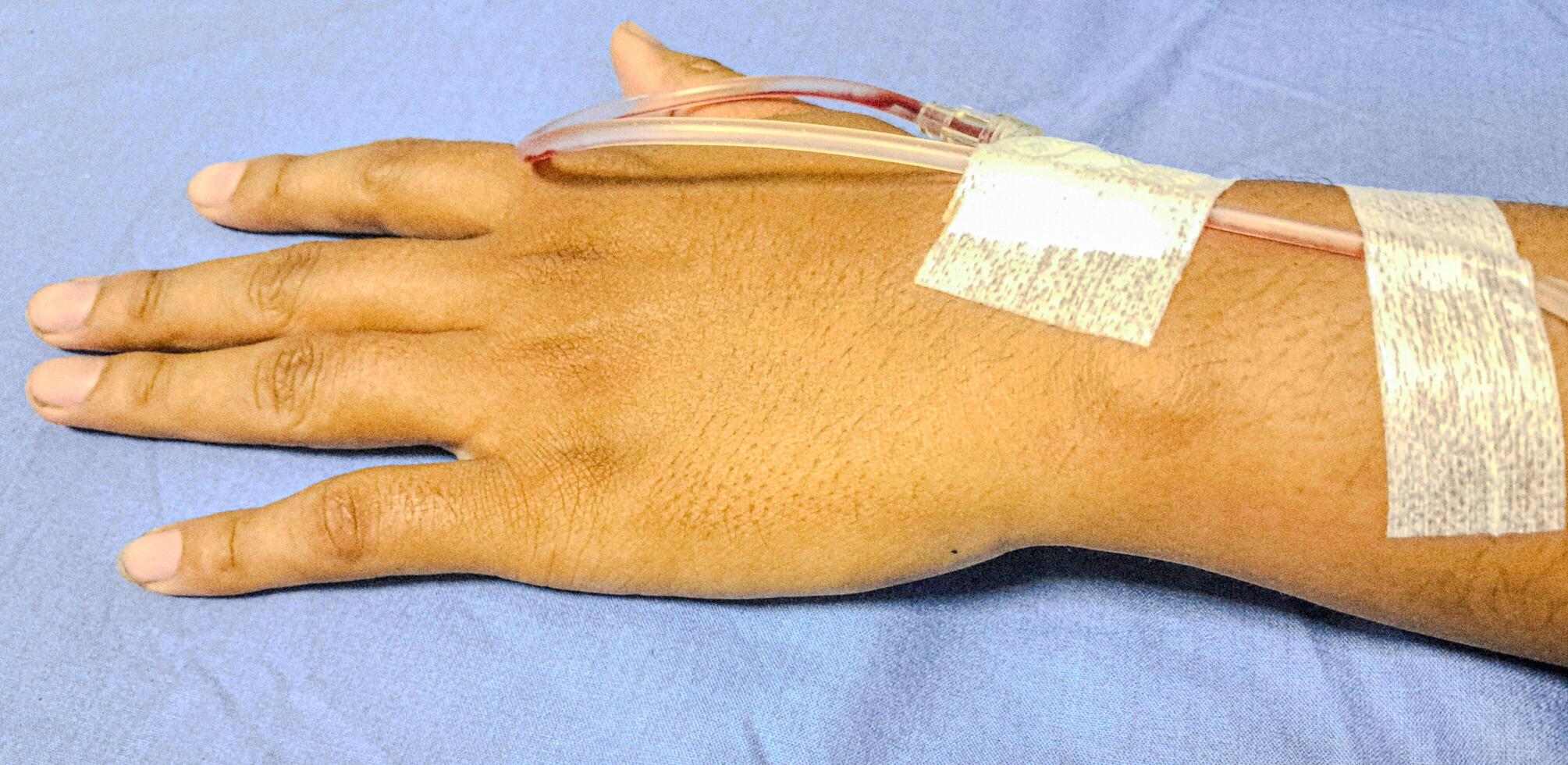 Hospital patient hand with saline solution in Intravenous Drip Dropper in hospital. photo