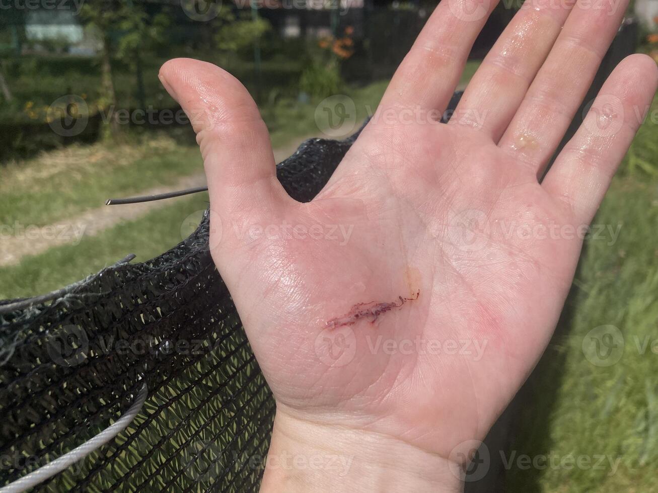 Wound cut on hand from wire photo