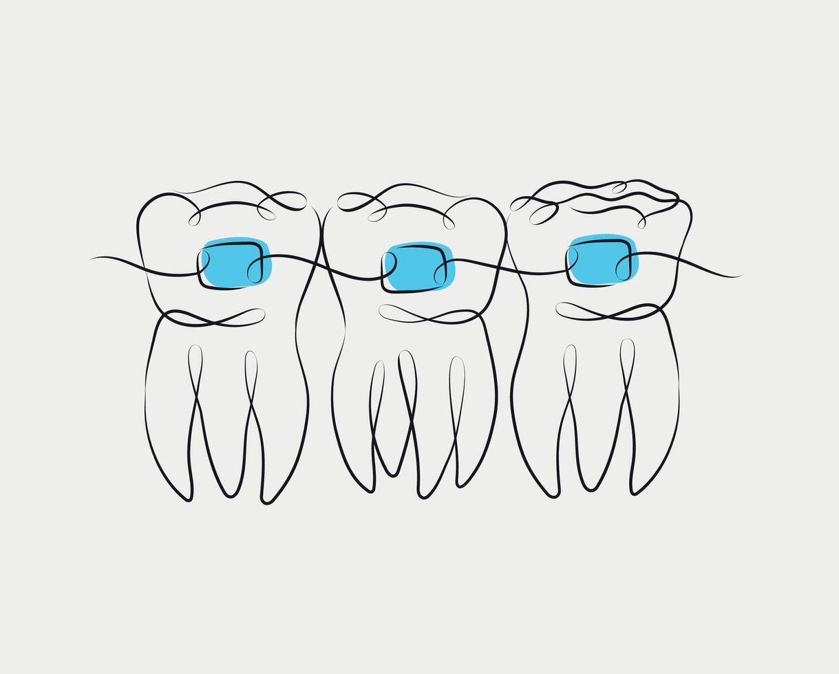 Teeth with braces illustration drawing in linear style on white and blue background vector