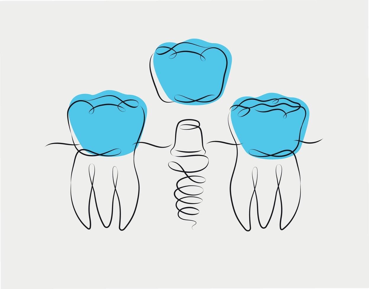 Teeth implant illustration drawing in linear style on white and blue background vector