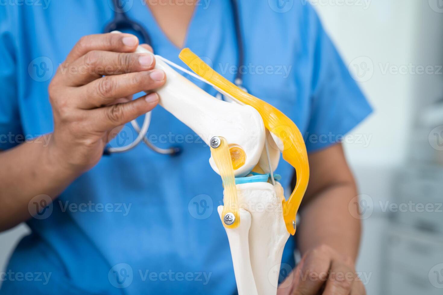 Osteoarthritis of the knee, Doctor holding human knee joint orthopedic anatomy model in hospital. photo
