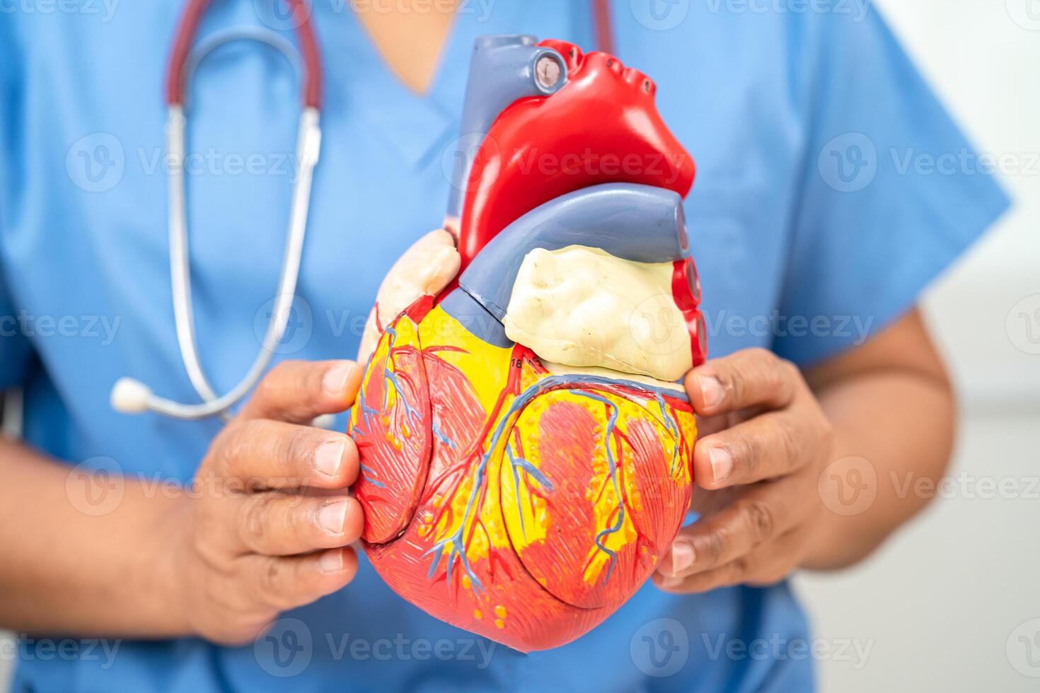 Cardiovascular disease CVD, Asian doctor holding human anatomy model for learn and treat heart disease. photo