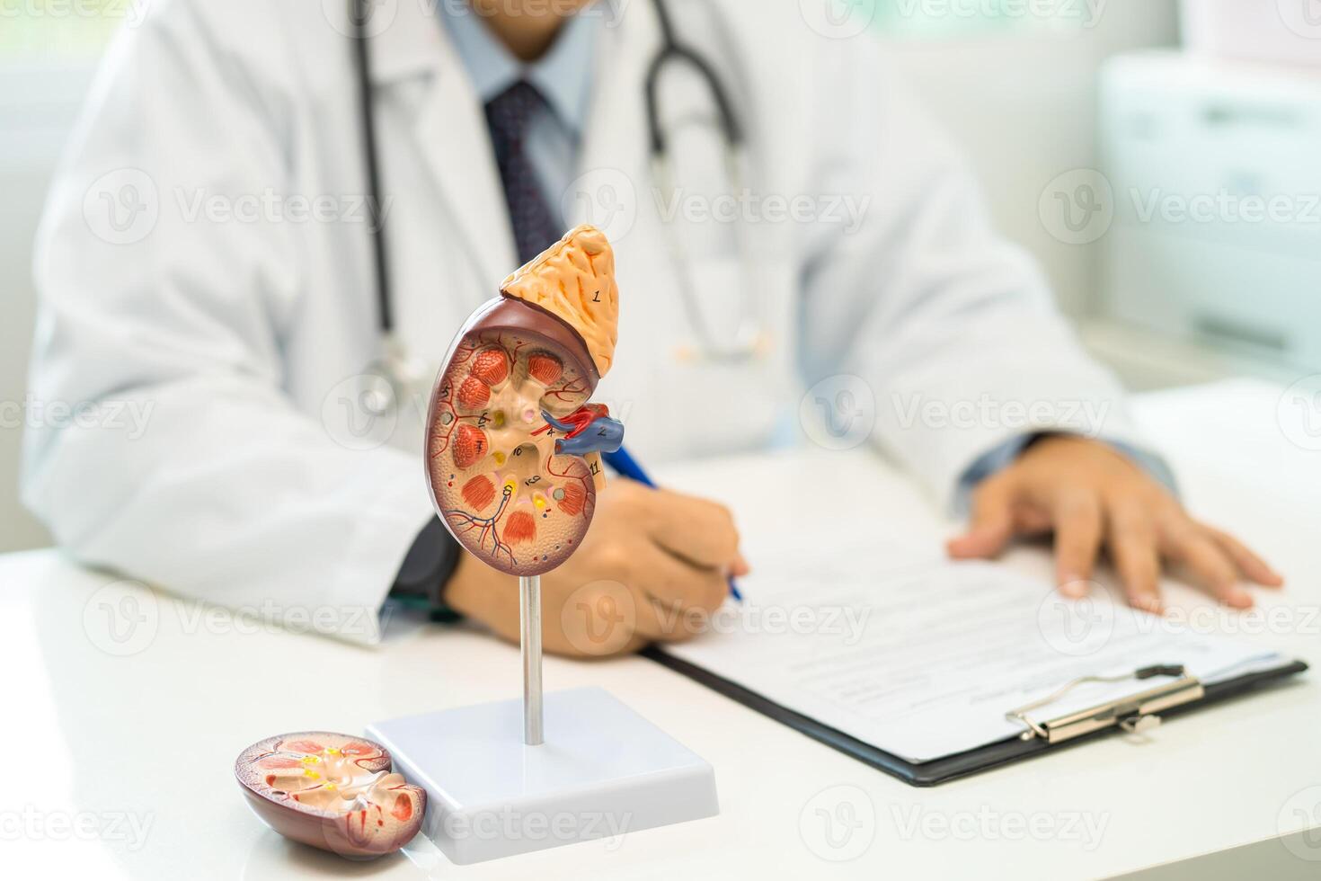 Kidney disease, Chronic kidney disease ckd, Doctor with human model to study and treat in hospital. photo