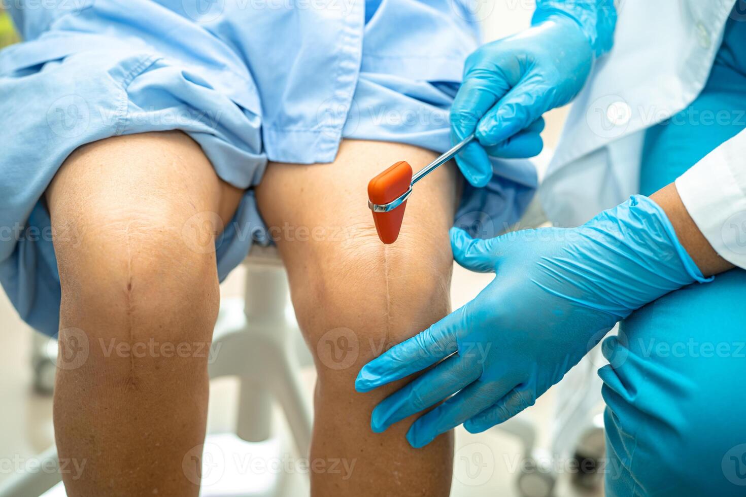Asian doctor use hammer knock senior woman patient to check knee reflex, nerve and muscle in hospital. photo