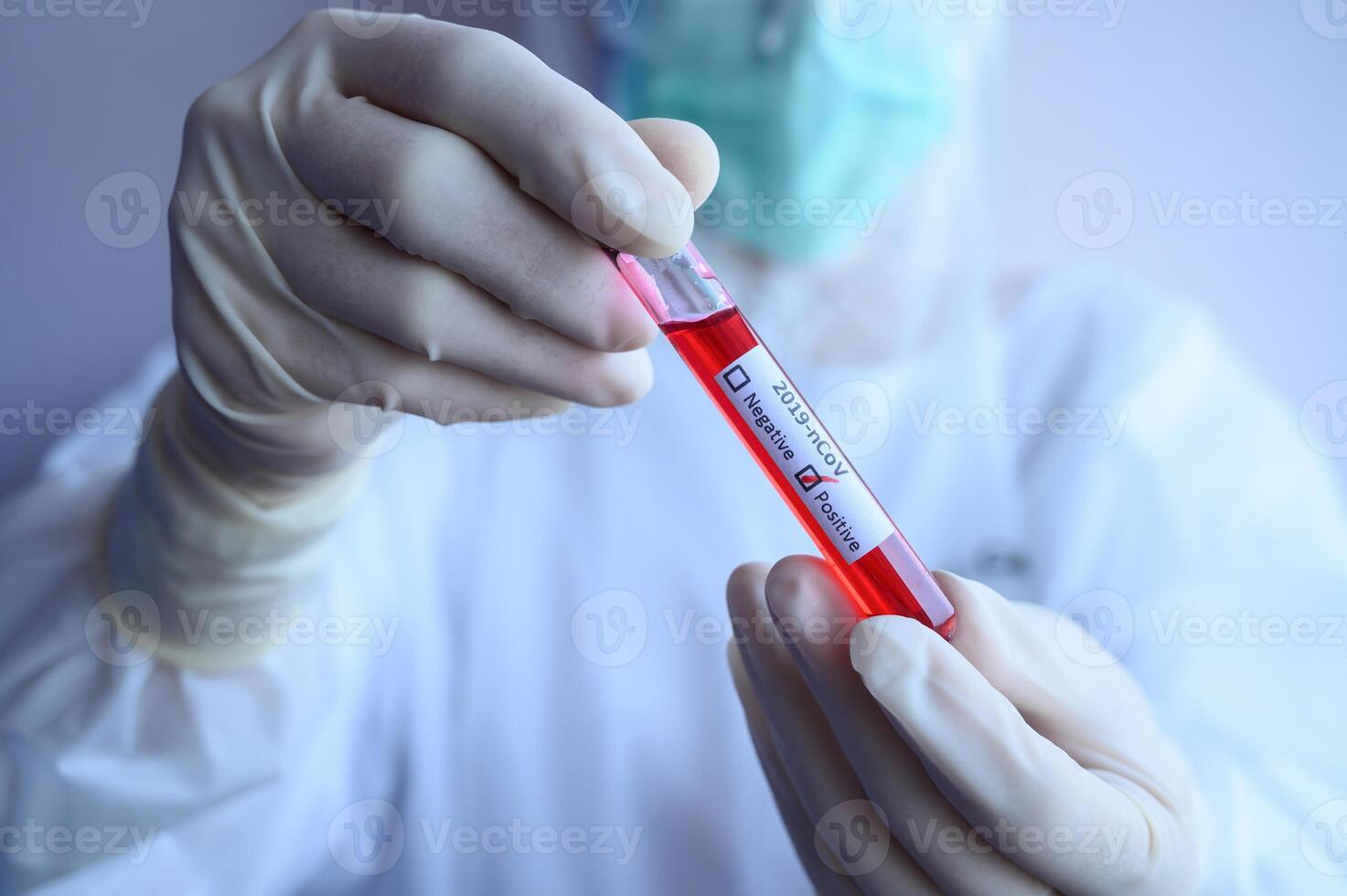 Scientist doctor holding a sample test tube with blood for 2019-nCoV analyzing. Conceptual of laboratory testing for the respiratory coronavirus disease 2019 photo