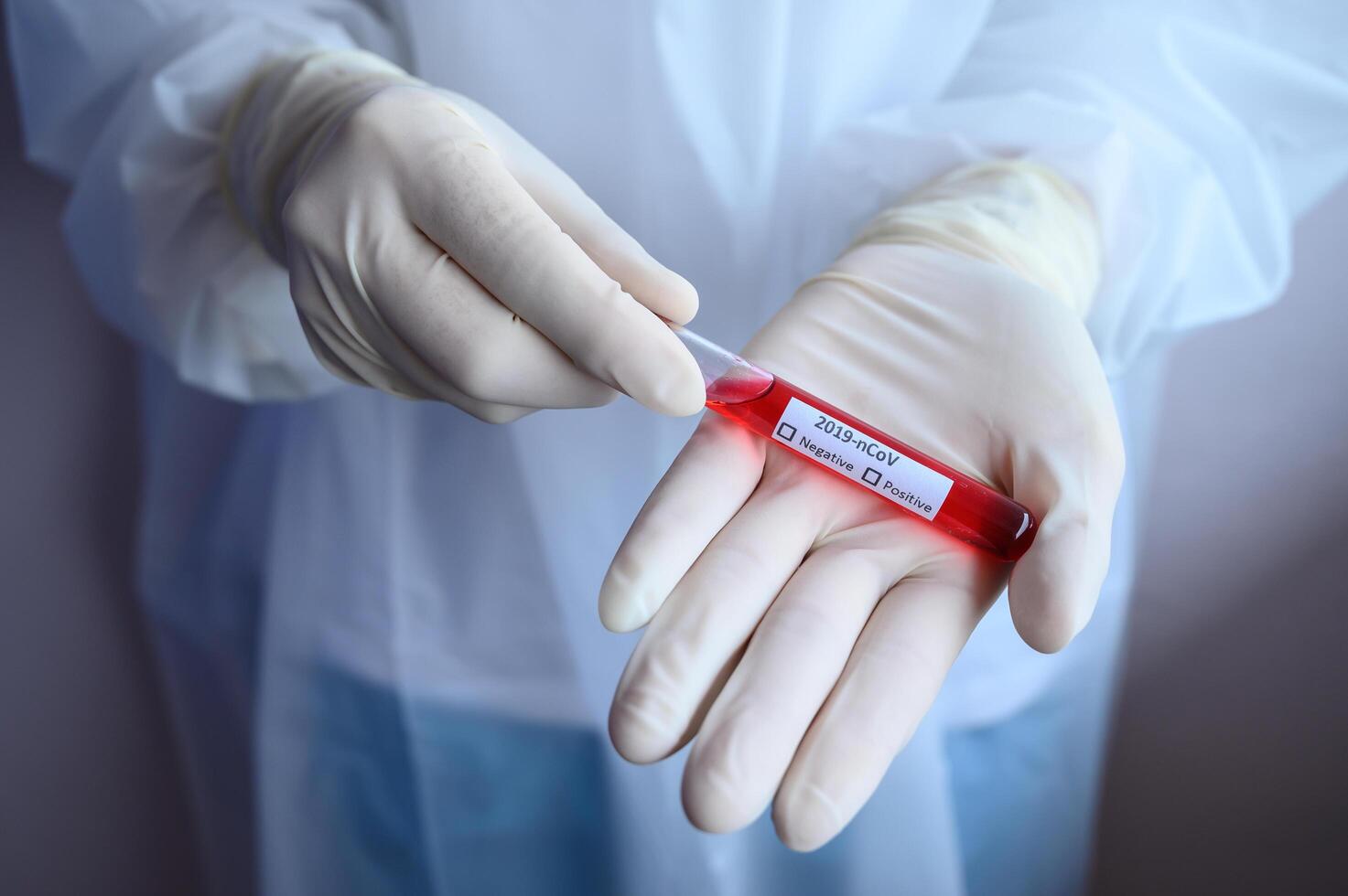 Close up of scientist doctor hand holding a sample test tube with blood for 2019-nCoV analyzing. Conceptual of laboratory testing for the respiratory coronavirus disease 2019. photo