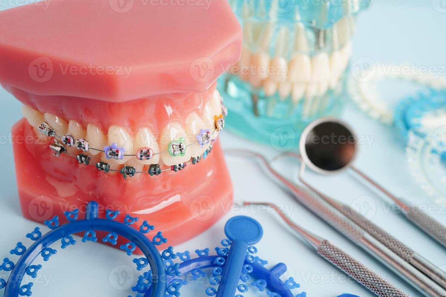 Orthodontic ligatures rings and ties, elastic rubber bands on orthodontic braces, model for dentist studying about dentistry. photo
