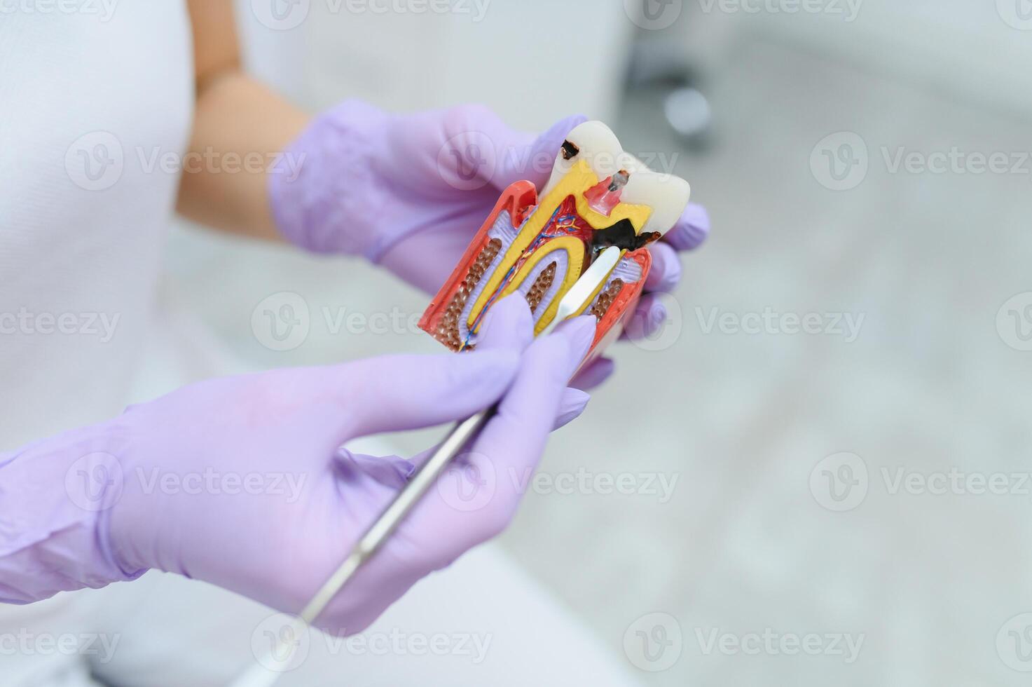 The concept of diagnosis and treatment of tooth disease. Doctor shows a model of a sick tooth. photo
