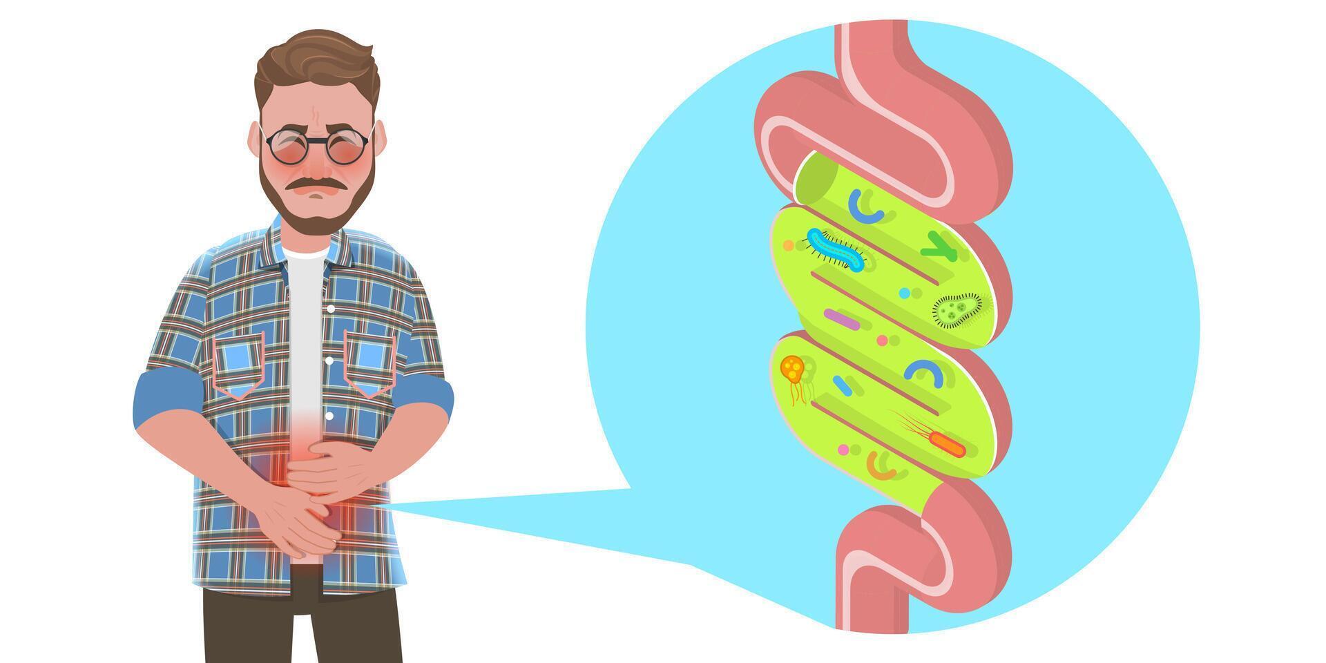 3D Isometric Flat Conceptual Illustration of Gut Inflammation. vector