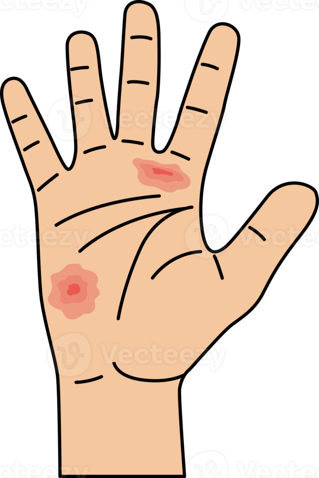 palm irritation illustration png