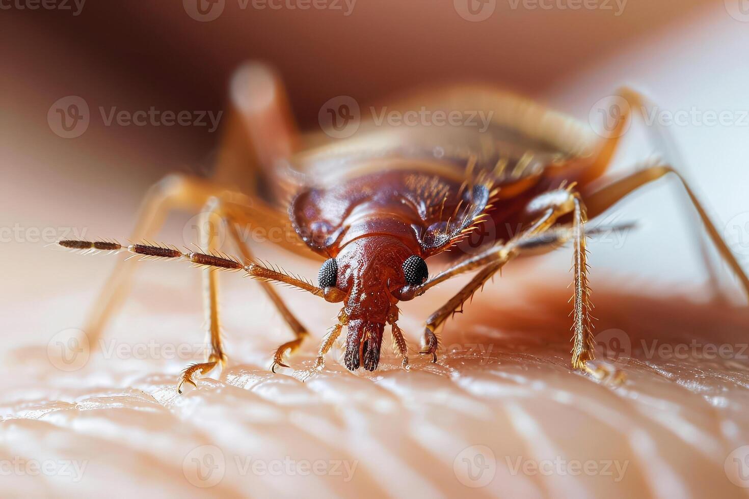 Close-up of a bed bug on skin - photo