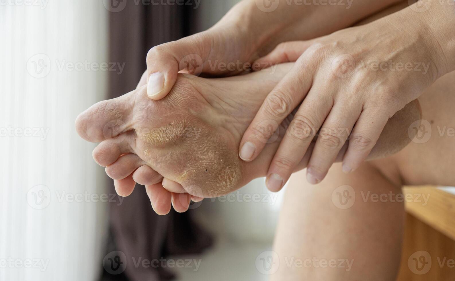 dirty and neglected feet photo