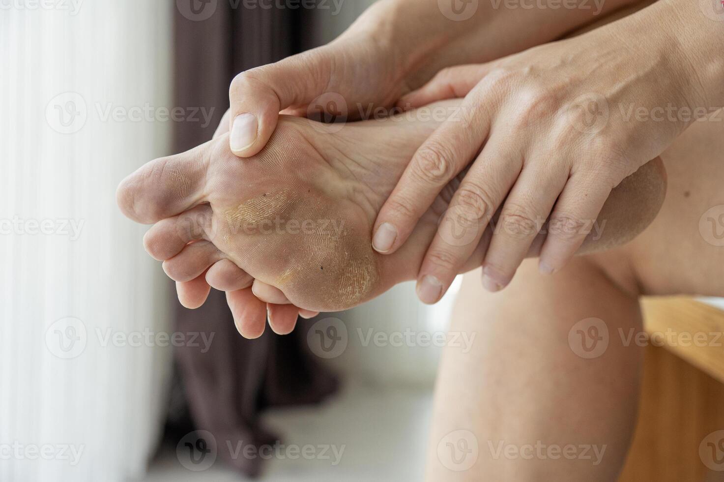 dirty and neglected feet photo