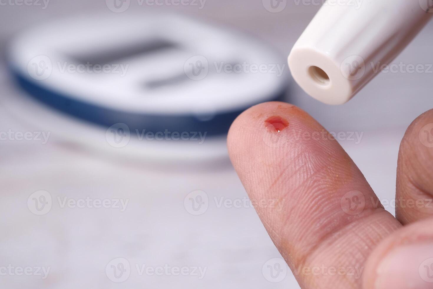 Finger prick blood test for monitoring glucose levels, vital for people with diabetes photo