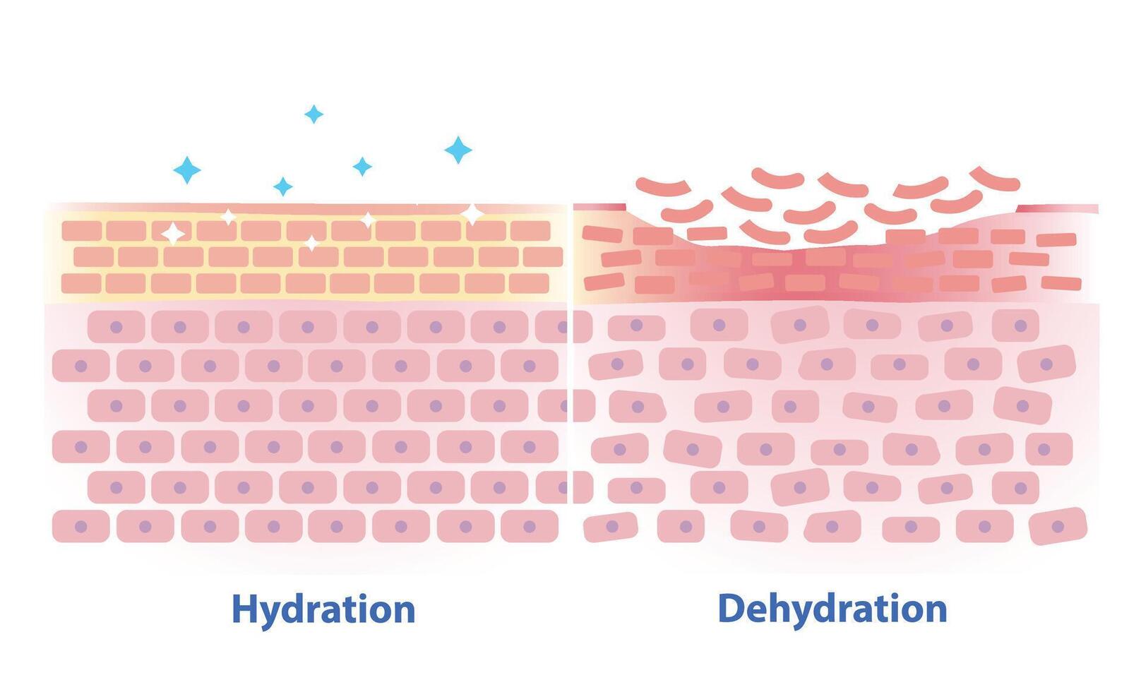 Comparison of hydration and dehydration skin illustration. Cross section of skin barrier layer hydration, attract, absorb water, moisture and the skin lacks water in the uppermost layer. vector