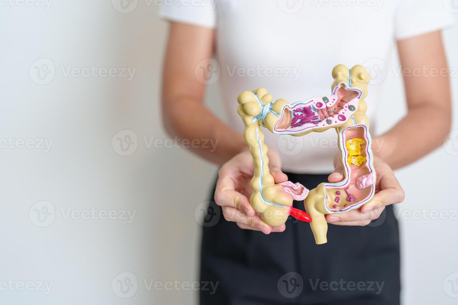 Woman holding human Colon anatomy model. Colonic disease, Large Intestine, Colorectal cancer, Ulcerative colitis, Diverticulitis, Irritable bowel syndrome, Digestive system and Health concept photo