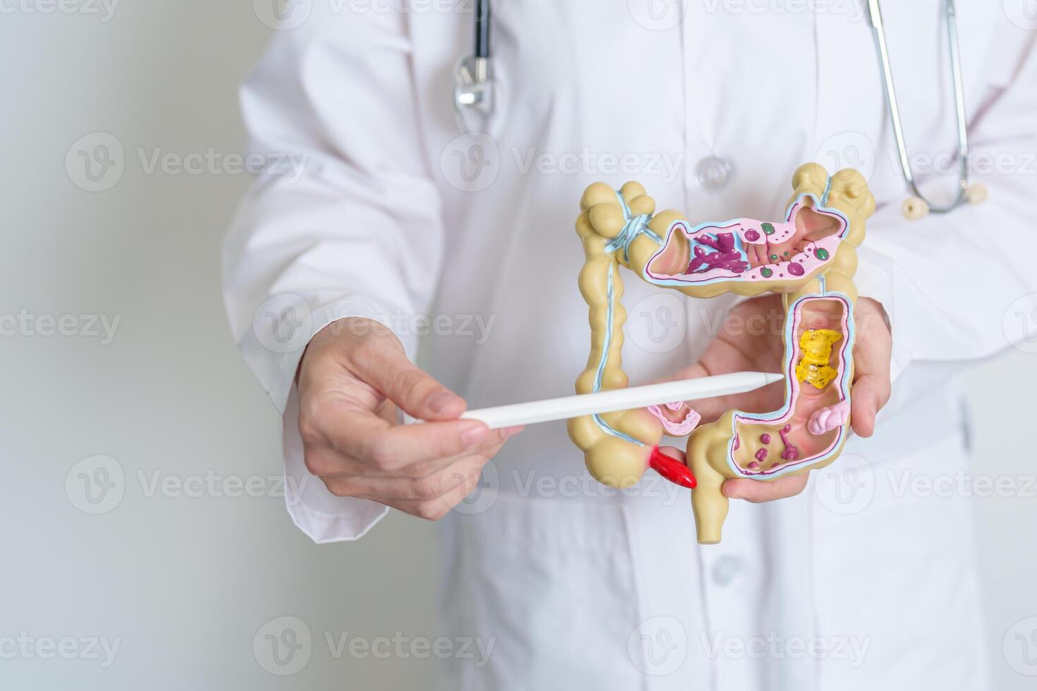 Doctor holding human Colon anatomy model. Colonic disease, Large Intestine, Colorectal cancer, Ulcerative colitis, Diverticulitis, Irritable bowel syndrome, Digestive system and Health concept photo
