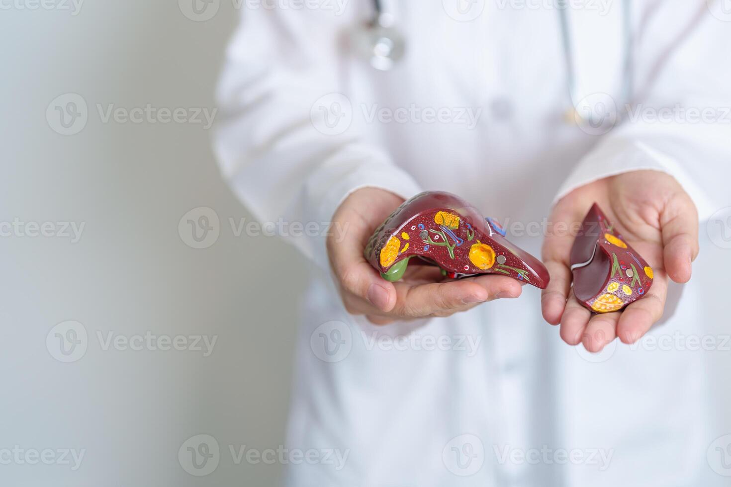 Doctor holding human Liver anatomy model. Liver cancer and Tumor, Jaundice, Viral Hepatitis A, B, C, D, E, Cirrhosis, Failure, Enlarged, Hepatic Encephalopathy, Ascites Fluid in Belly and health photo