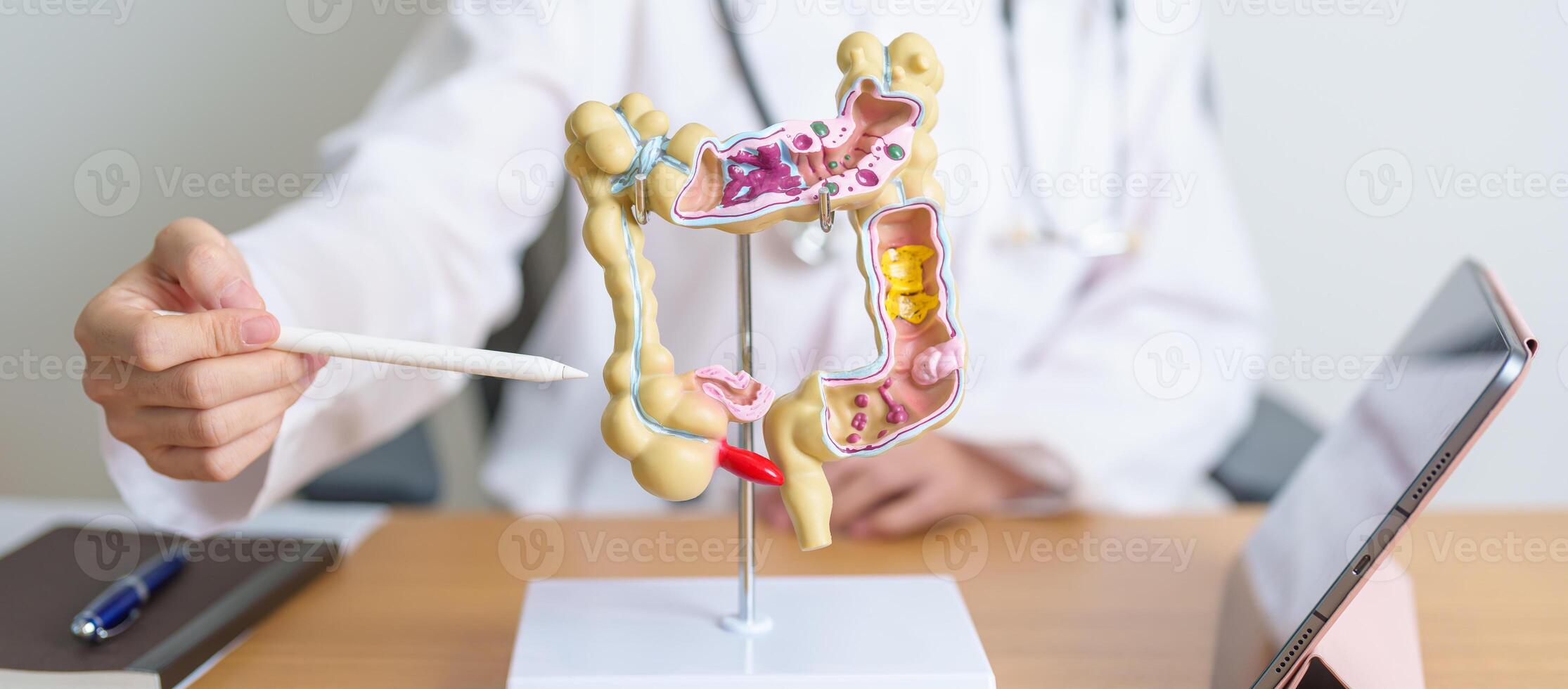 Doctor with human Colon anatomy model and tablet. Colonic disease, Large Intestine, Colorectal cancer, Ulcerative colitis, Diverticulitis, Irritable bowel syndrome and Digestive system photo