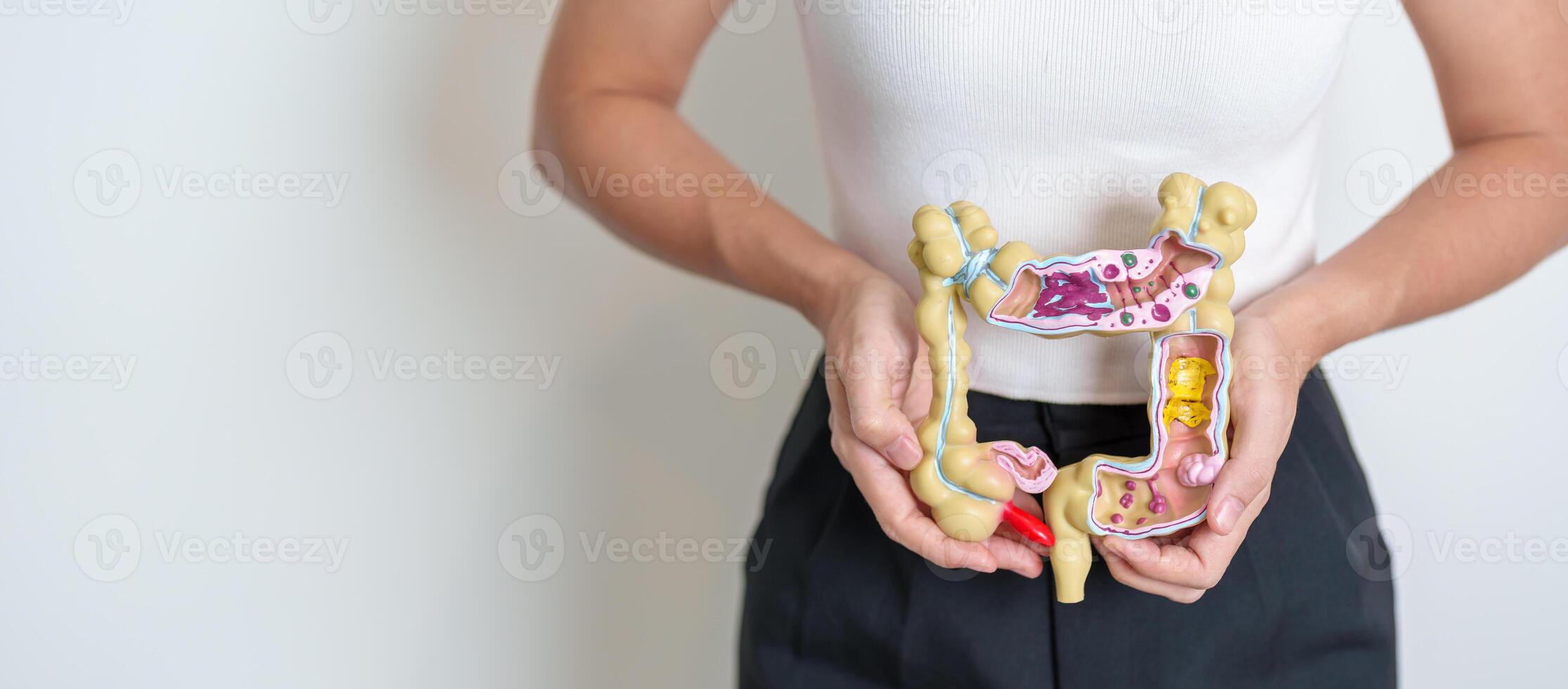Woman holding human Colon anatomy model. Colonic disease, Large Intestine, Colorectal cancer, Ulcerative colitis, Diverticulitis, Irritable bowel syndrome, Digestive system and Health concept photo