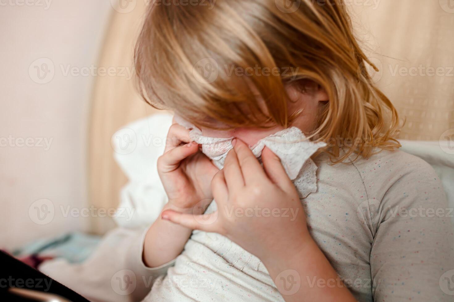 sick child with a cold sneezes in a napkin photo
