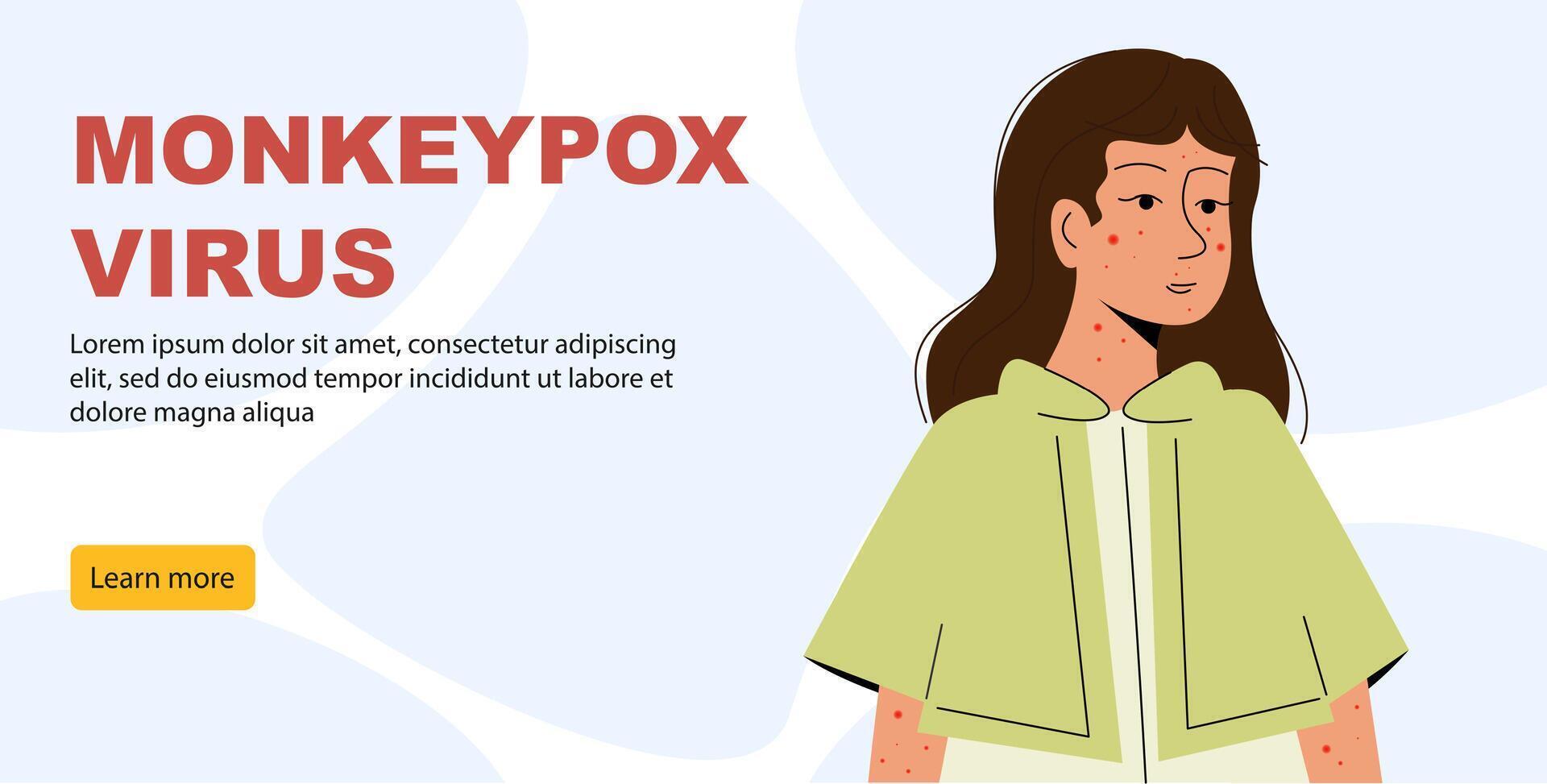 Monkeypox outbreak concept banner. Infected girl from monkey flat illustration. Monkeypox on human skin vector
