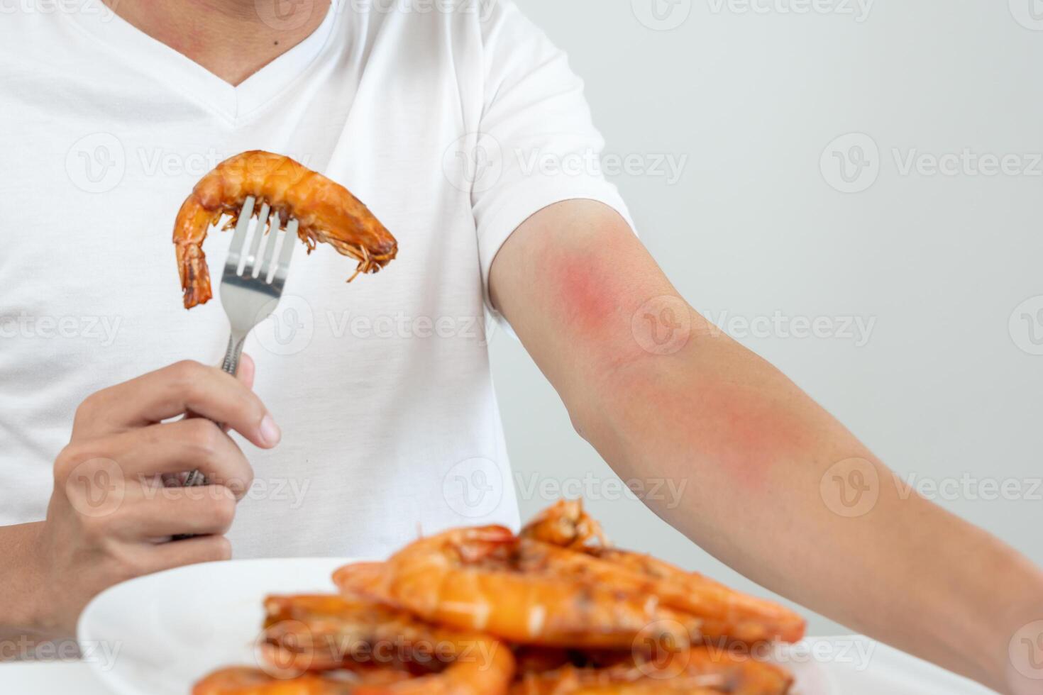 food allergies, men have reactions itching and redness after eating