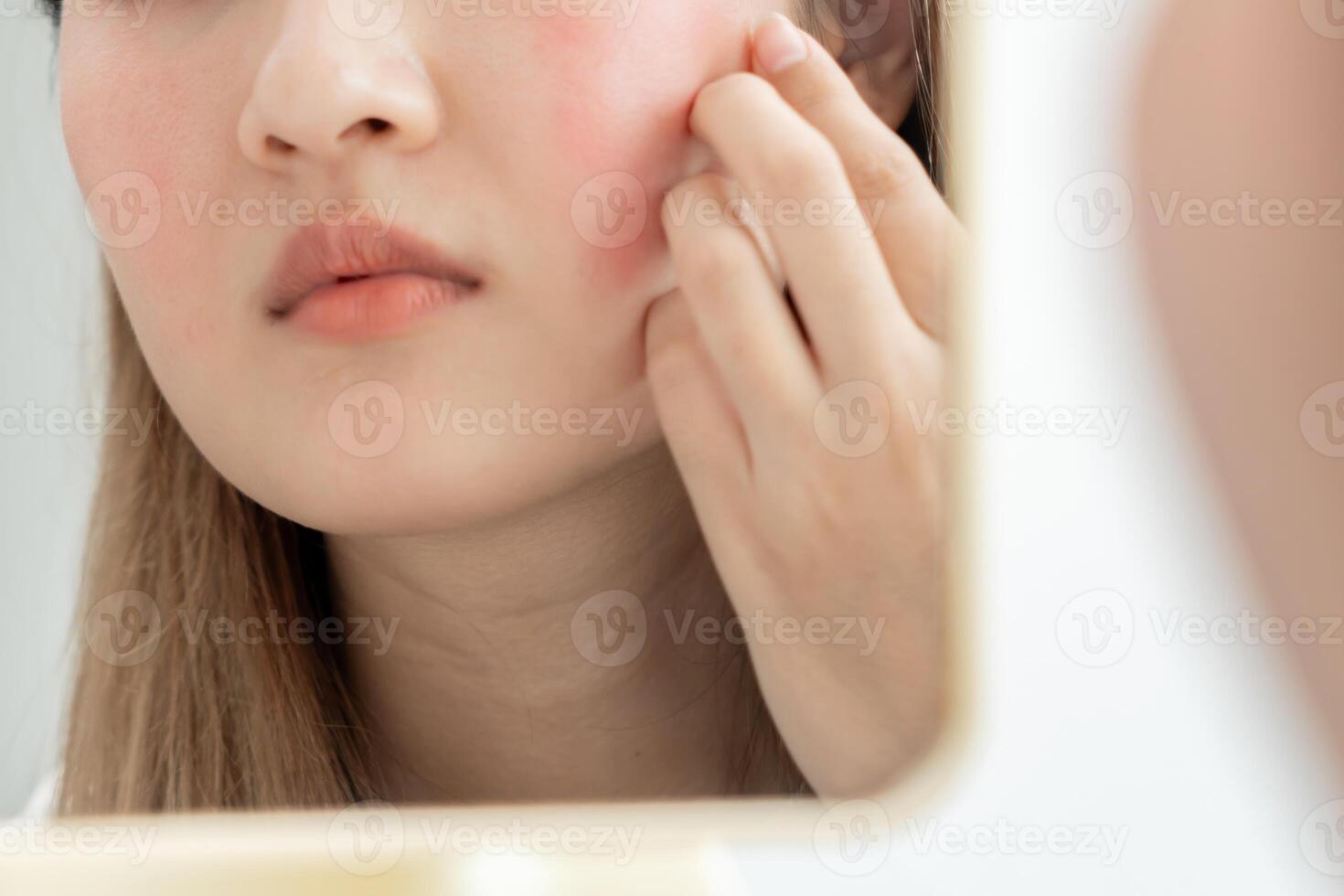 woman asian are worried about faces Dermatology and allergic to steroids in cosmetics. sensitive skin, red face from sunburn, acne, allergic to chemicals, rash on face. skin problems and beauty photo