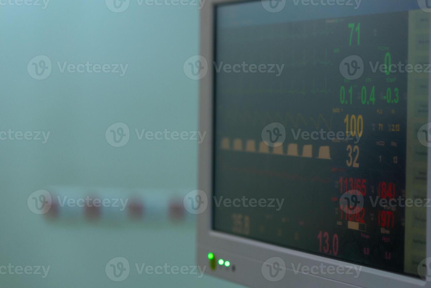 Close-up view of hospital monitor displaying vital signs in operating room photo