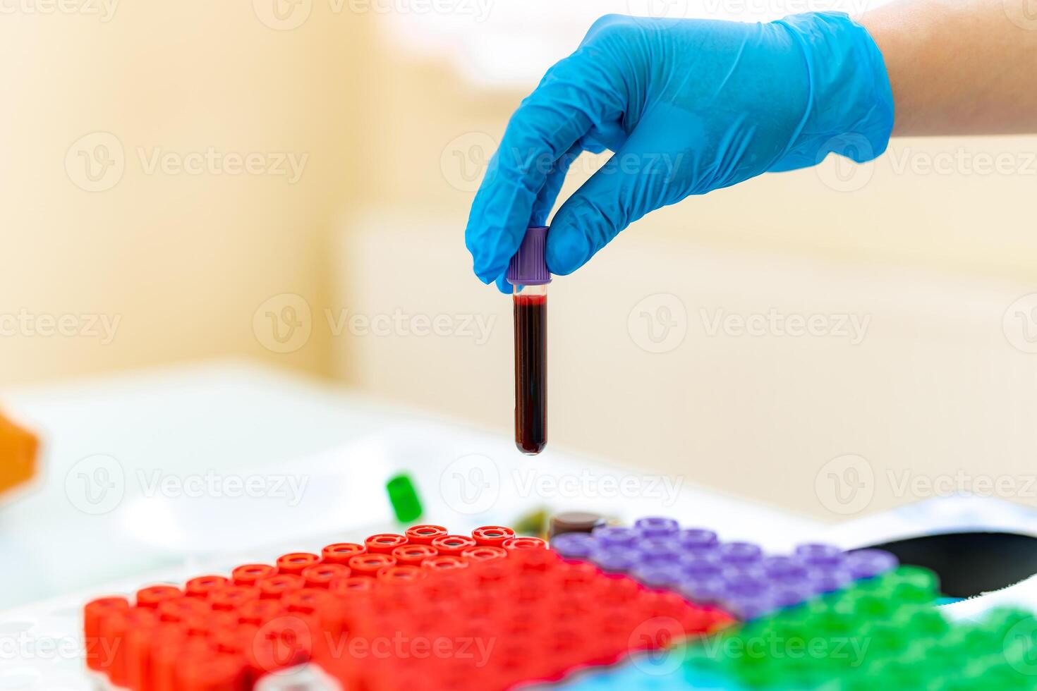 Hand of a doctor holding a bottle of blood sample photo