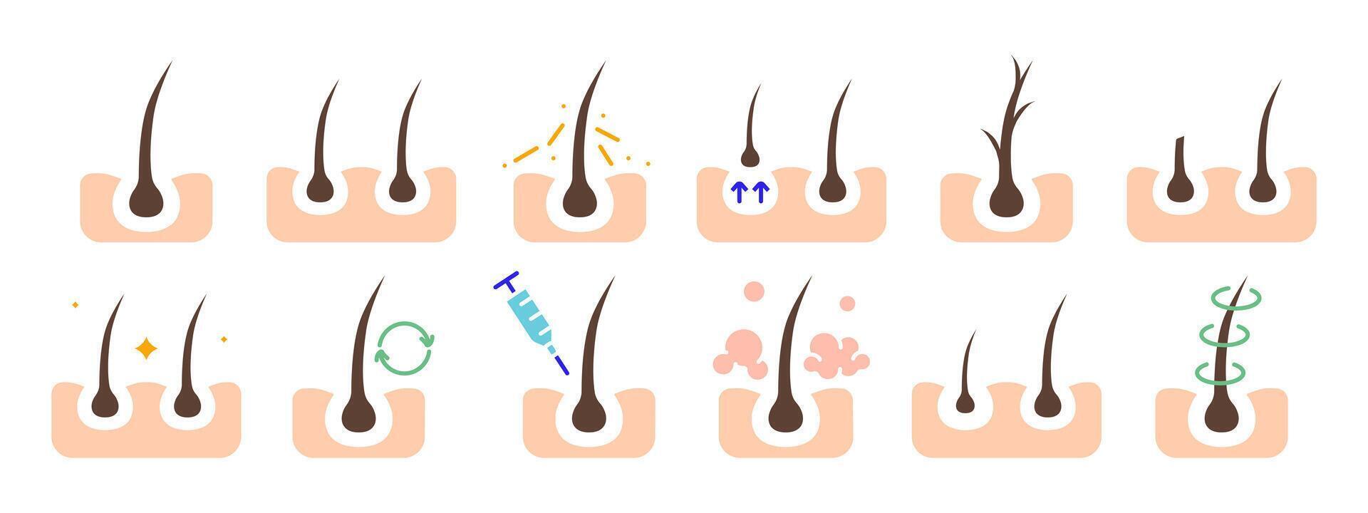 Hair growth set icon. Hair follicle stages, growth cycle, scalp care, injection, dermatology, treatment, hair loss prevention, hair health. vector