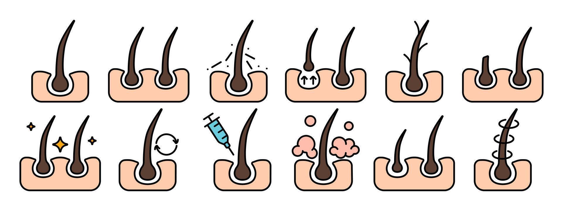 Hair growth set icon. Hair follicle stages, growth cycle, scalp care, injection, dermatology, treatment, hair loss prevention, hair health. vector