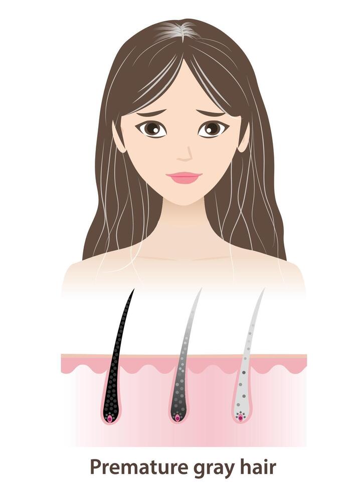 The woman with premature gray hair illustration isolated on white background. The mechanism of hair graying with scalp layer. Hair anatomy, hair structure and hair care concept. vector