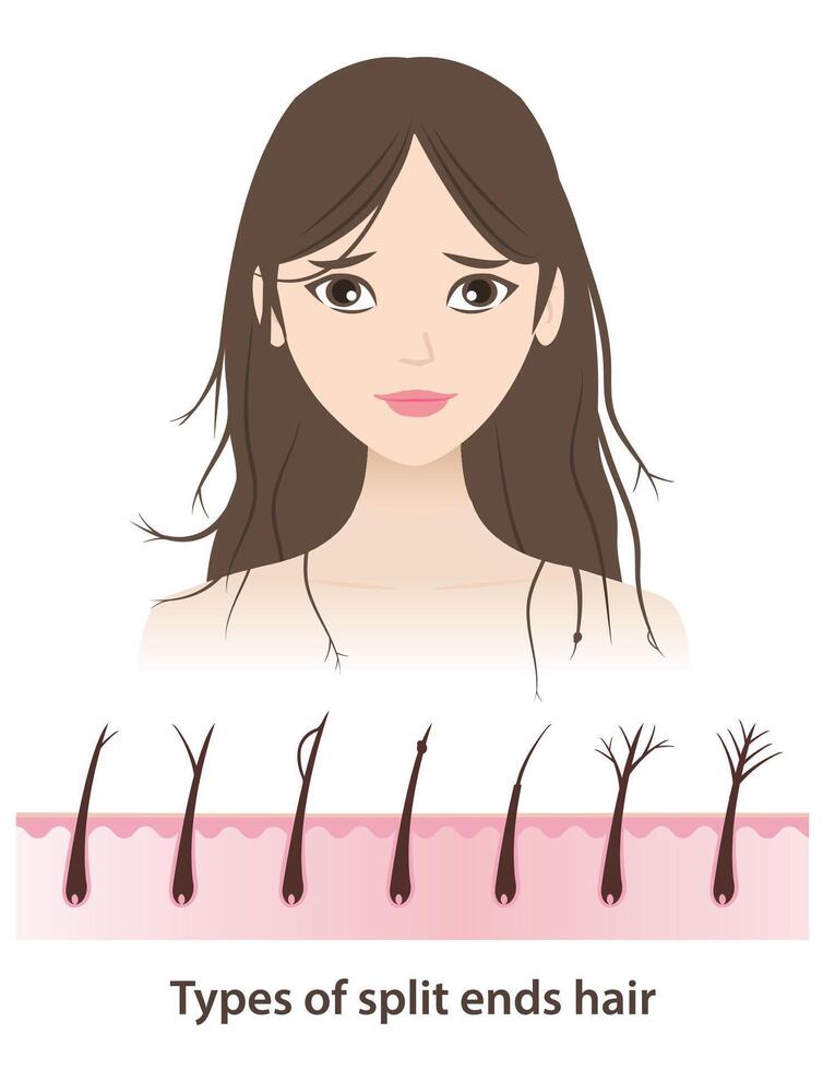 The woman with types of split ends hair illustration on white background. Cross section of baby split, y split, incomplete, knot, taper, tree, feather with scalp layer. Hair care concept. vector