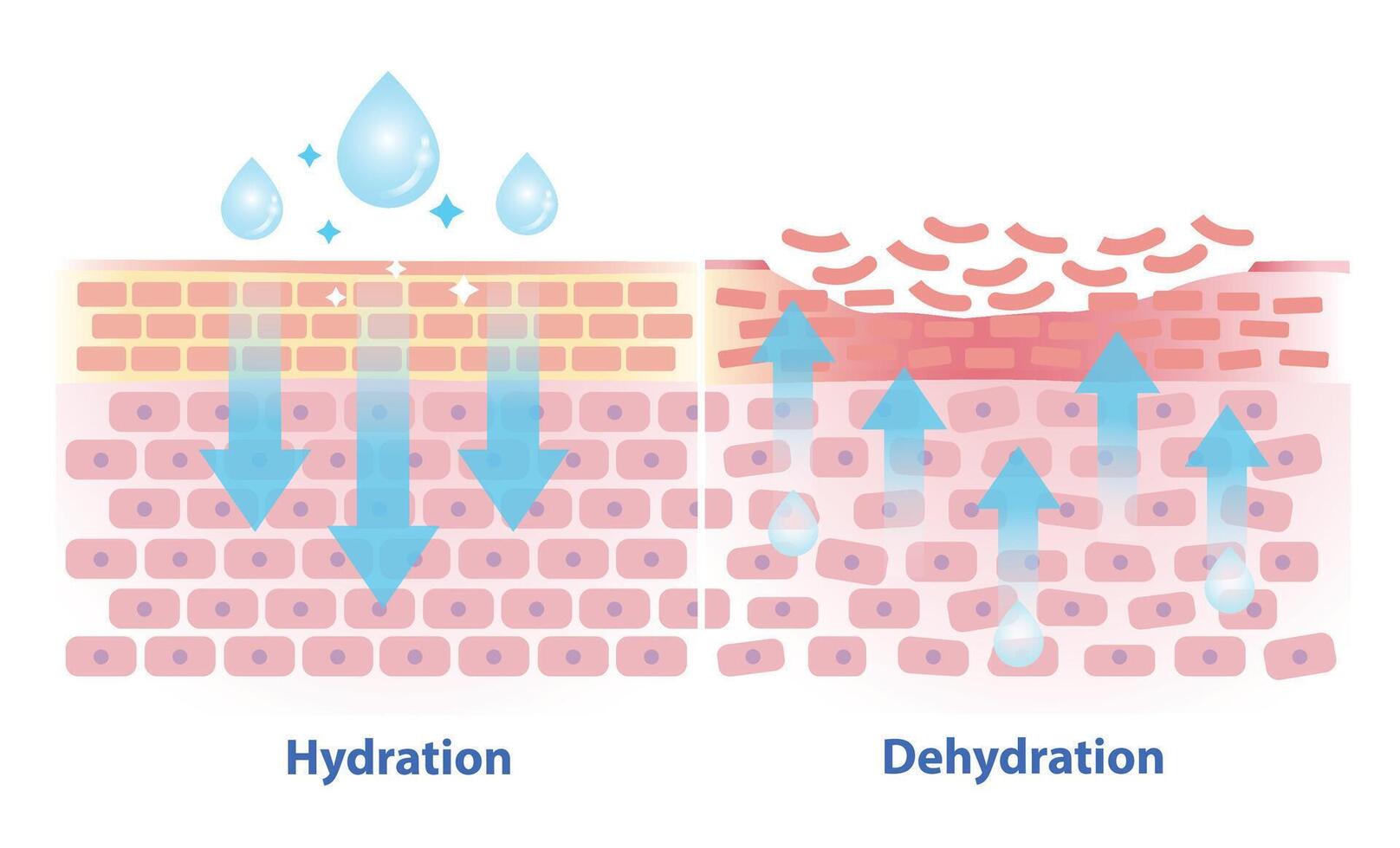 The mechanism of hydration and dehydration skin layer illustration isolated on white background. Comparison of skin absorb water, moisture and dry skin lacks water in the uppermost layer. vector