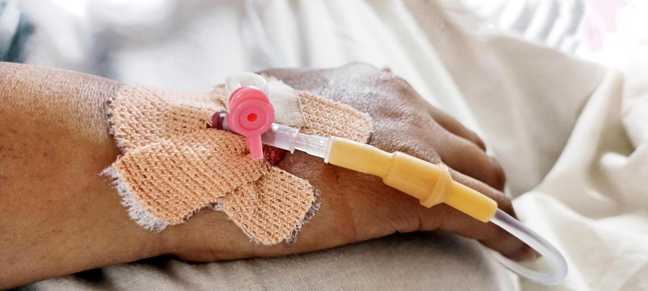 Young woman with a cannula inserted into her right hand and lying on a bed at a hospital, in order to administer intravenous fluids. photo