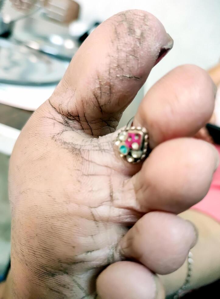 Close up of Indian woman foot with cracks photo