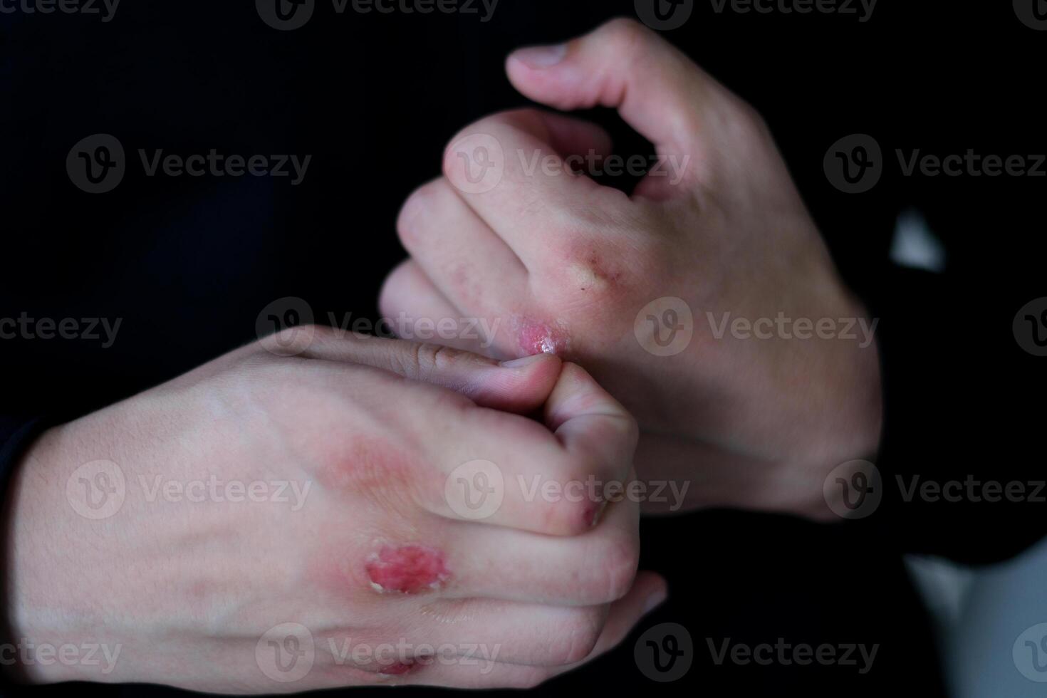 Close up boxing trainer or manager wrapping hands of a boxer reparing for boxing match boxer with broken hands bleeding puts on a black shirt. Handsome man with black hair and blue eyes. Mixed race photo