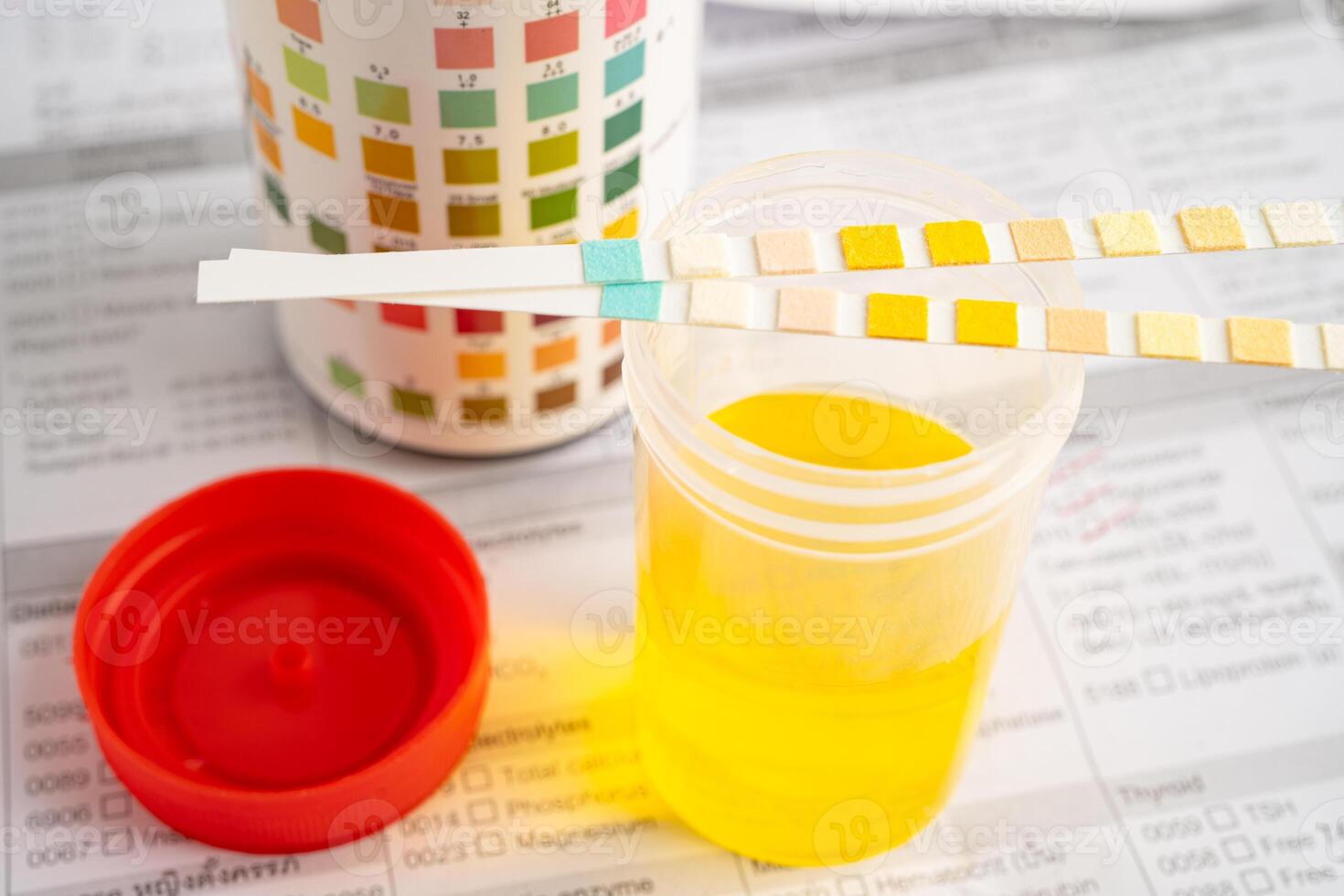 Urinalysis, urine cup with reagent strip pH paper test and comparison chart in laboratory. photo