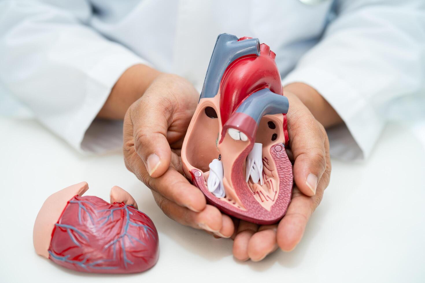 Cardiovascular disease CVD, Asian doctor holding human anatomy model for learn and treat heart disease. photo