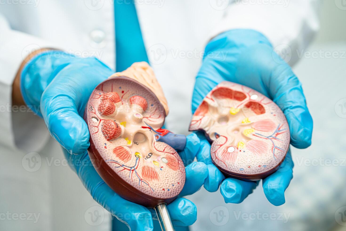 Kidney disease, Chronic kidney disease ckd, Doctor hold human model to treat and study in hospital. photo