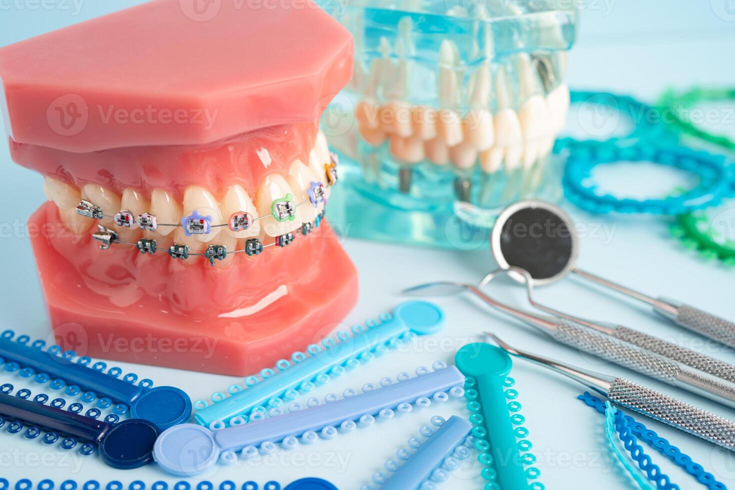 Orthodontic ligatures rings and ties, elastic rubber bands on orthodontic braces, model for dentist studying about dentistry. photo