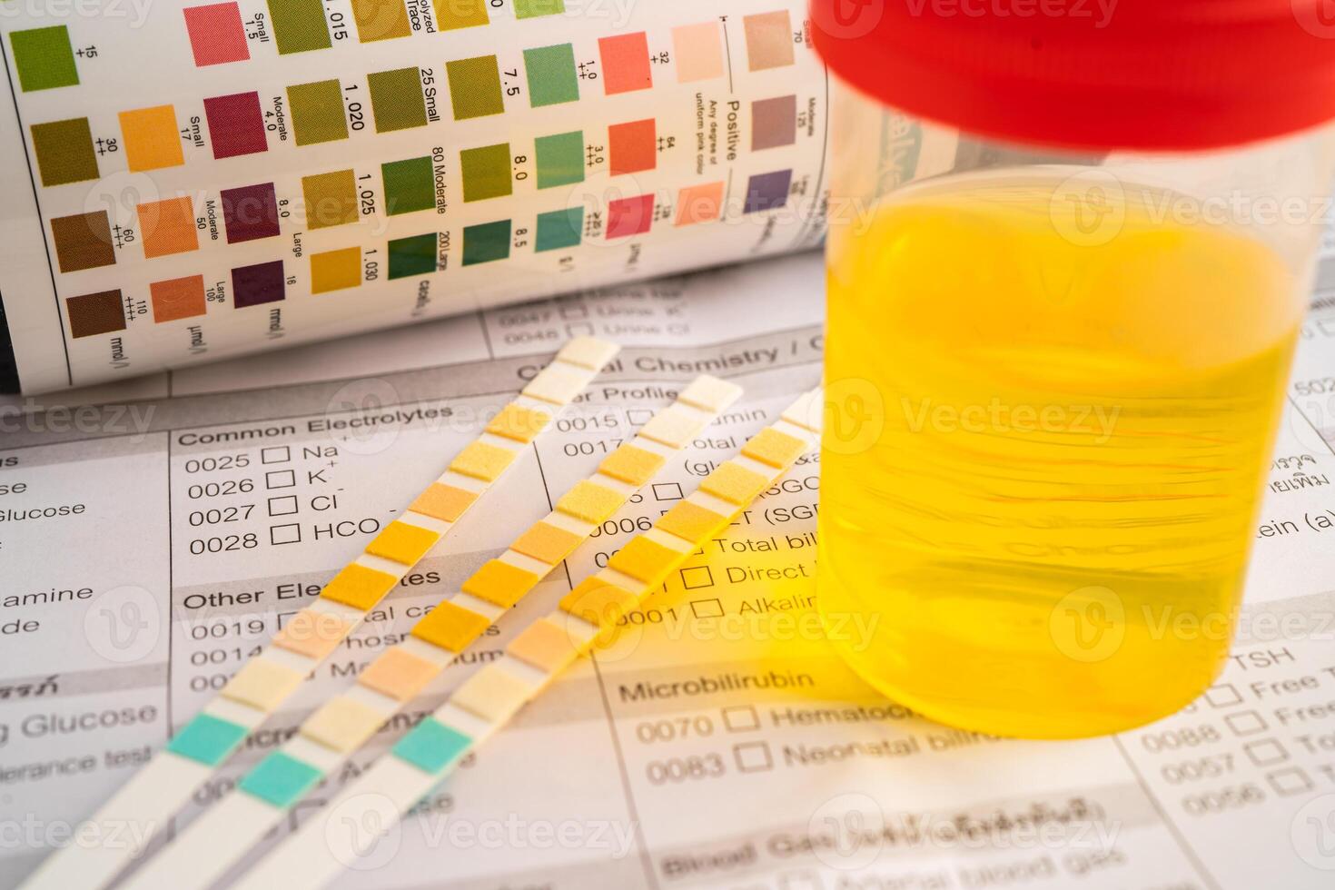 Urinalysis, urine cup with reagent strip pH paper test and comparison chart in laboratory. photo