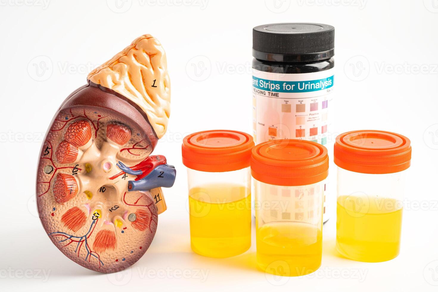 Urinalysis, Kidney model and urine cup with reagent strip pH paper test and comparison chart in laboratory. photo