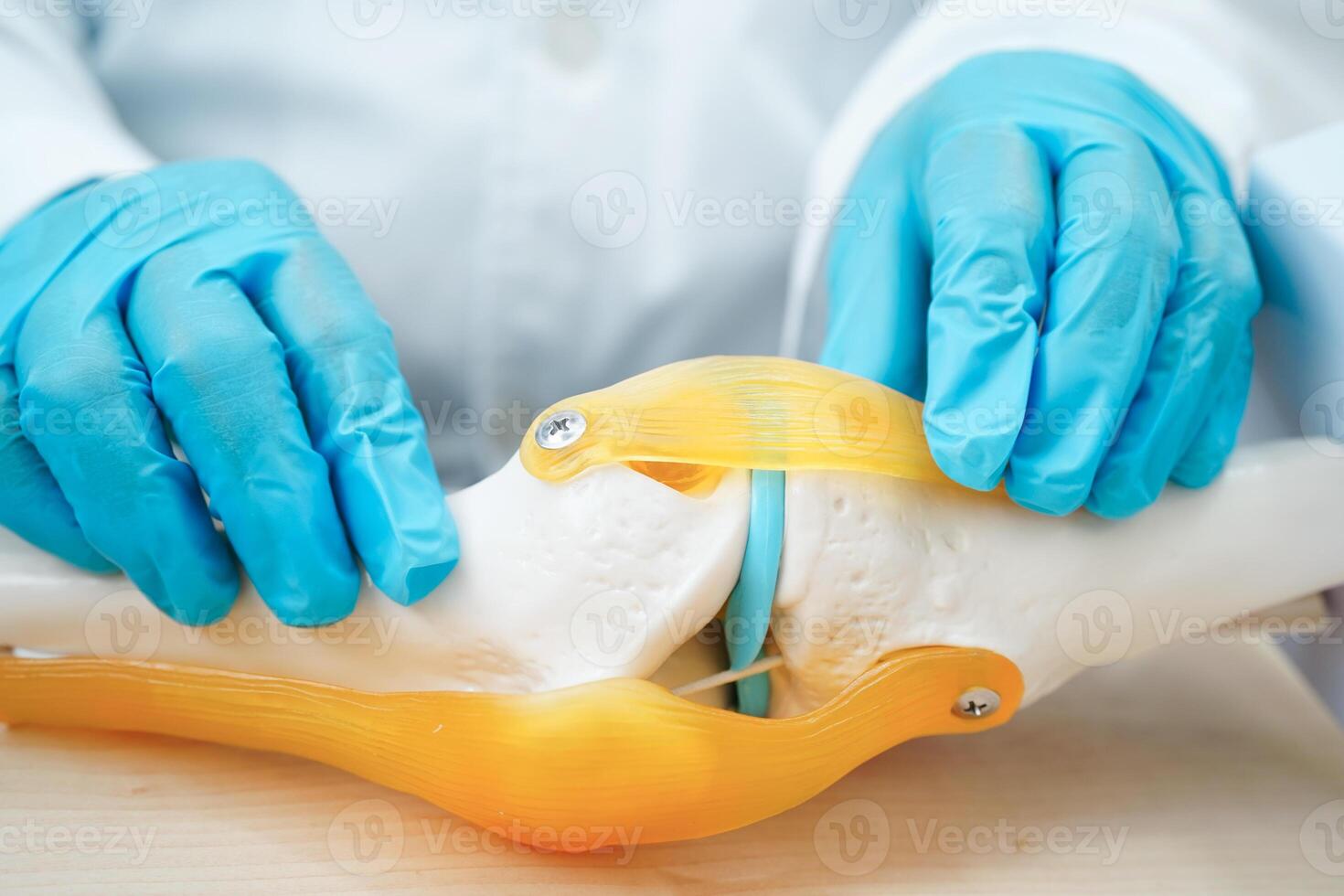 Knee osteoarthritis, Doctor showing model knee joint orthopedic. photo