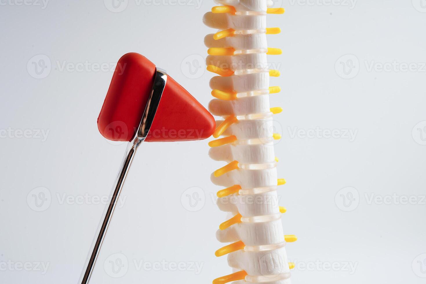 Spinal nerve and bone with knee reflex hammer, Lumbar spine displaced herniated disc fragment, Model for treatment medical in the orthopedic department. photo